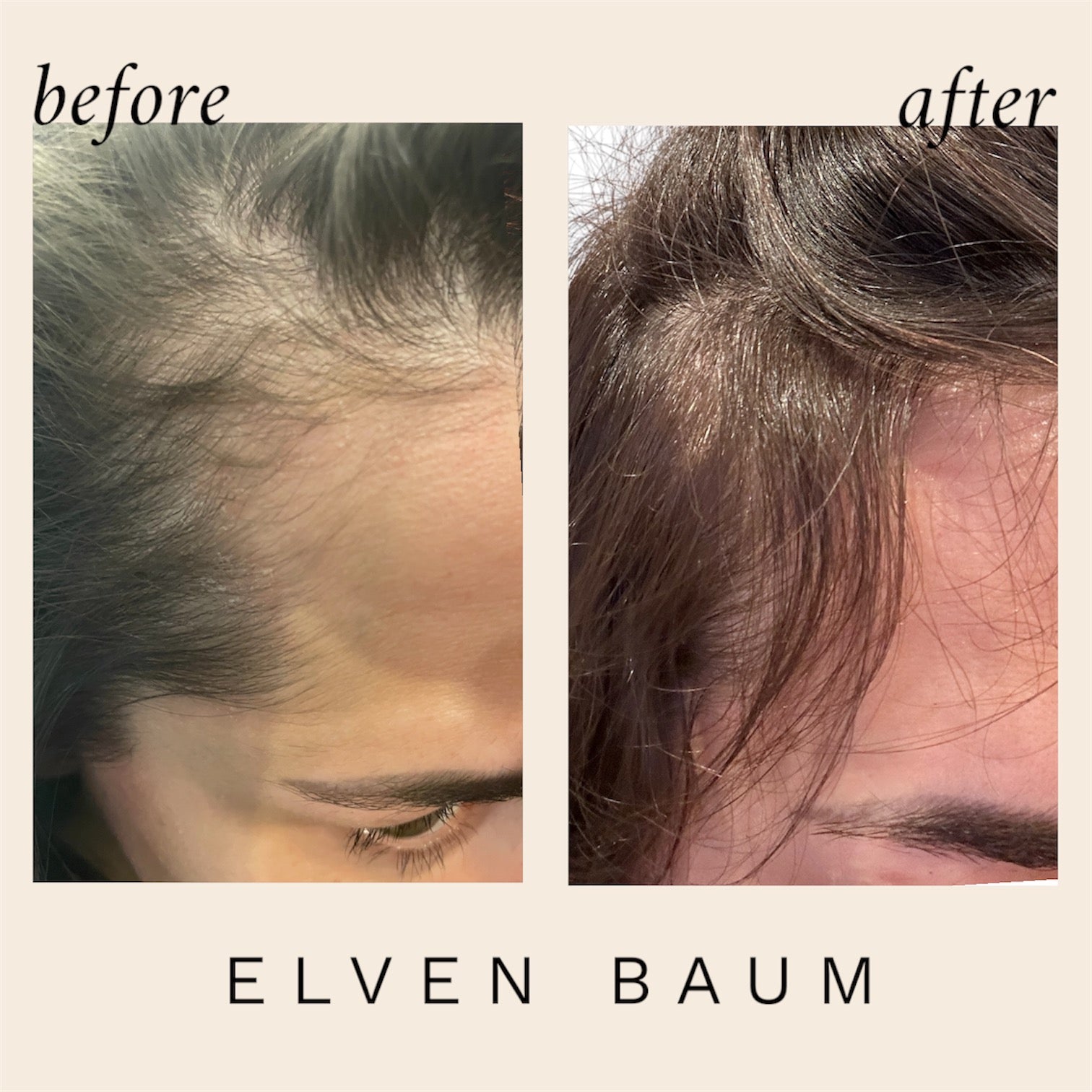 Elven Baum Hair Growth Oil Trio – Save & Flourish